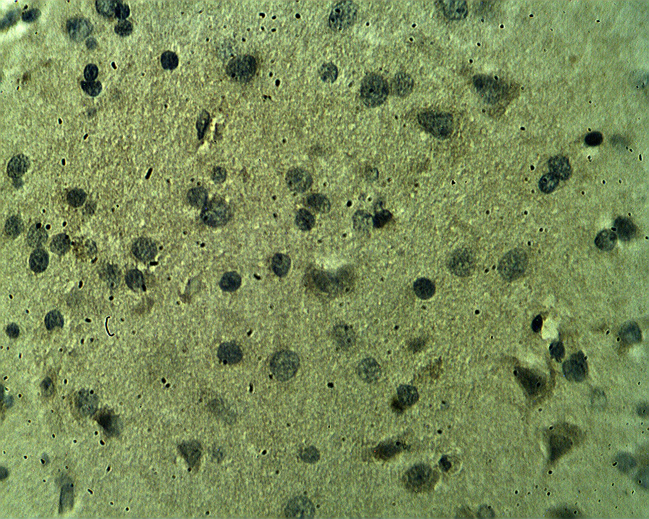 Immunohistochemical staining of human brain tissue using CSP alpha antibody (Cat. No. X2406) at 10 µg/ml.